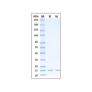 Recombinant Human TRAIL Protein,Recombinant Human TRAIL Protein