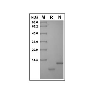 Recombinant Human Uteroglobin Protein,Recombinant Human Uteroglobin Protein