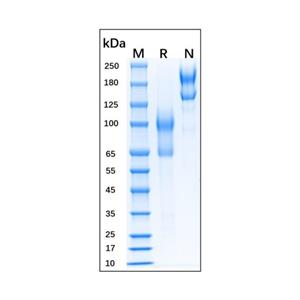 Recombinant Mouse L-Selectin/CD62L Protein,Recombinant Mouse L-Selectin/CD62L Protein