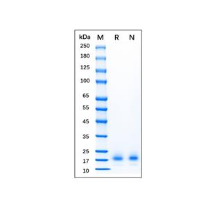 Recombinant Mouse IL-4 Protein,Recombinant Mouse IL-4 Protein