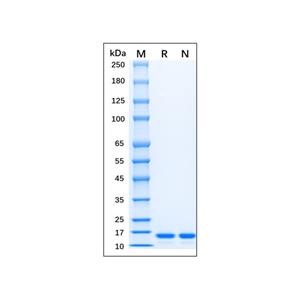 Recombinant Mouse TNF-alpha Protein,Recombinant Mouse TNF-alpha Protein