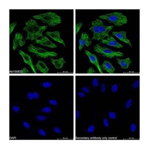 Streptavidin protein (FITC),Streptavidin protein (FITC)