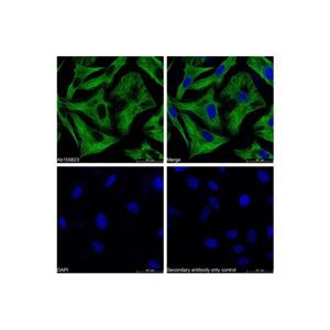 aladdin 阿拉丁 Ab156254 Goat Anti-Mouse IgG H&L (FITC) Secondary Antibody; Goat Anti-Mouse IgG H&L (FITC); IF, Flow