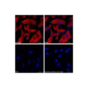 aladdin 阿拉丁 Ab156257 Goat Anti-Mouse IgG H&L (Cy5) Secondary Antibody; Goat Anti-Mouse IgG H&L (Cy5); IF, Flow