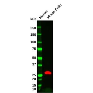 SDHB Mouse mAb,SDHB Mouse mAb