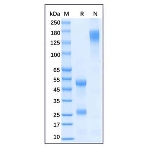 aladdin 阿拉丁 Ab175968 Horse IgG ≥ 95%; Isotype Control Antibody; Horse IgG; Unconjugated