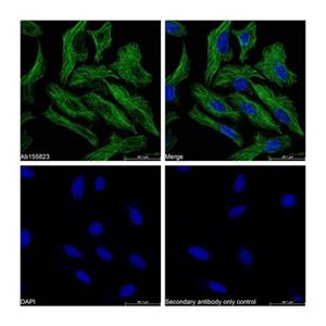 aladdin 阿拉丁 Ab179003 Goat Anti-Mouse IgG H&L (FITC) Secondary Antibody; Goat Anti-Mouse IgG H&L (FITC); IF, Flow