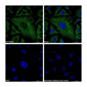 alpha Tubulin Mouse mAb,alpha Tubulin Mouse mAb