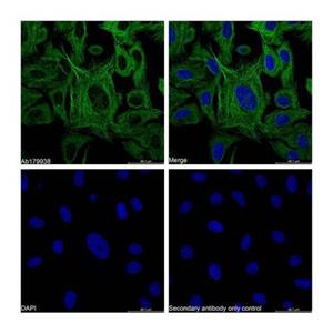 alpha Tubulin Mouse mAb,alpha Tubulin Mouse mAb