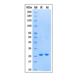 aladdin 阿拉丁 rp155829 Recombinant Schistosoma japonicum GST Protein Carrier Free, >95% SDS-PAGE, E.coli, His, 1-218 aa