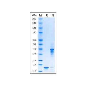 aladdin 阿拉丁 rp155836 Recombinant MPXV A29L Protein Carrier free, >95% (SDS-PAGE), E. coli, His tag, 1-110 aa