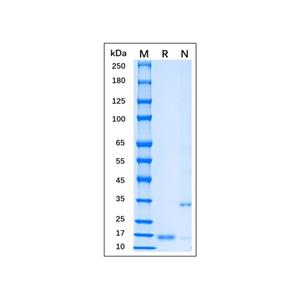 aladdin 阿拉丁 rp155843 Recombinant MPXV A35R Protein Carrier free , >95% (SDS-PAGE), E. coli, N-His tag, 58-181 aa