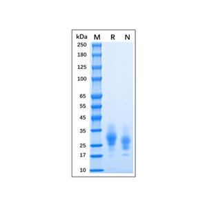 aladdin 阿拉丁 rp155933 Recombinant MPXV A30L Protein Animal Free, >95% (SDS-PAGE), 293 cell, C-His tag, 26-146 aa