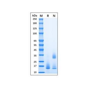 aladdin 阿拉丁 rp155934 Recombinant MPXV A35R Protein Animal Free, >95% (SDS-PAGE), 293 cell, C-His tag, 58-181 aa