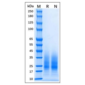 aladdin 阿拉丁 rp155935 Recombinant MPXV M1R Protein Animal Free, >95% (SDS-PAGE), 293 cell, C-His tag, 1-183 aa