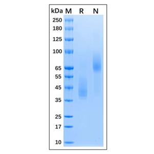 Recombinant MPXV E8L Protein,Recombinant MPXV E8L Protein