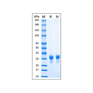 aladdin 阿拉丁 rp155938 Recombinant MPXV H3L Protein Animal Free, >95% (SDS-PAGE), 293 cell, C-His tag, 1-278 aa