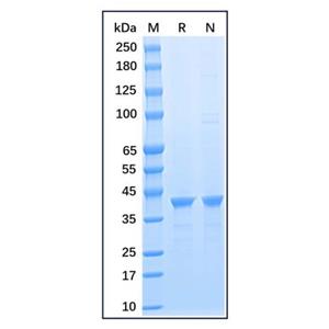 aladdin 阿拉丁 rp156145 Recombinant Human GAPDH Protein Carrier free, >95% SDS-PAGE, E.coli, N-His tag, 1-335 aa