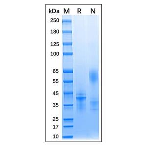 Recombinant Human IL-12 Protein,Recombinant Human IL-12 Protein