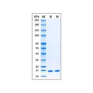 Recombinant Human IFN-gamma Protein,Recombinant Human IFN-gamma Protein