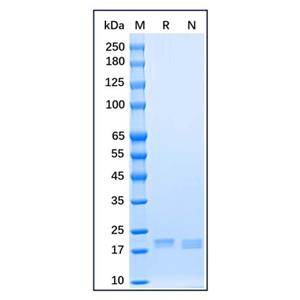 aladdin 阿拉丁 rp156336 Recombinant Human Sonic Hedgehog Protein Carrier Free, >95%(SDS-PAGE), E.coli, No Tag, 24-197 aa