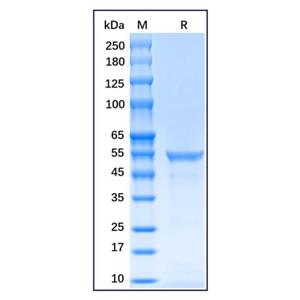 aladdin 阿拉丁 rp156639 Recombinant Human Vimentin Protein Carrier Free, >90%(SDS-PAGE), E.coli, C-His tag, 1-466 aa