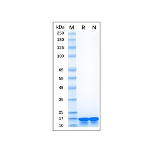 aladdin 阿拉丁 rp156641 Recombinant Human AIF-1/Iba1 Protein Carrier free, >90% (SDS-PAGE), E.coli, N-His tag, 1-147 aa