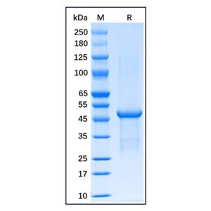 aladdin 阿拉丁 rp156651 Recombinant Human FOXP3 Protein Carrier Free, >90% SDS-PAGE, E.coli, N-His tag, 1-431 aa