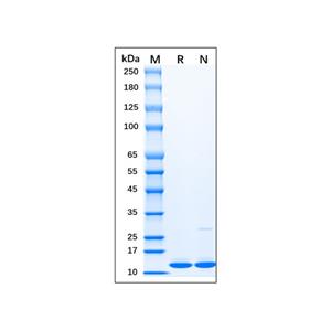 Recombinant Human Doublecortin Protein,Recombinant Human Doublecortin Protein