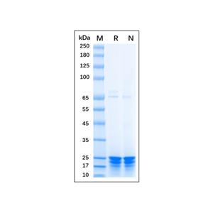 aladdin 阿拉丁 rp156658 Recombinant Human TAGLN/Transgelin Protein Carrier free, >90% (SDS-PAGE), E.coli, N-His tag, 1-201 aa