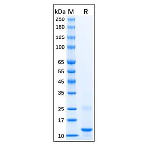 Recombinant Human CTGF Protein,Recombinant Human CTGF Protein