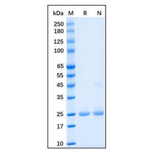 aladdin 阿拉丁 rp156665 Recombinant Human SOD2/MnSOD Protein Carrier Free, >90% (SDS-PAGE), E.coli, N-His tag, 25-222 aa