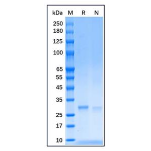 aladdin 阿拉丁 rp156670 Recombinant Human SDHB Protein Carrier Free, >90% (SDS-PAGE), E.coli, His tag, 29-280 aa