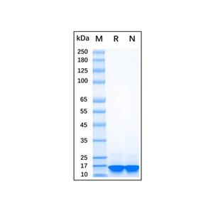 aladdin 阿拉丁 rp156673 Recombinant Human Alpha-synuclein Protein Carrier free, >90% (SDS-PAGE), E.coli, N-His tag, 1-140 aa