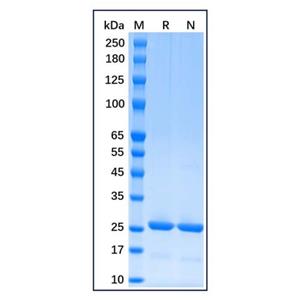 aladdin 阿拉丁 rp156681 Recombinant Human Bcl-2 Protein Carrier Free, >90%(SDS-PAGE), E.coli, C-His tag, 1-211 aa