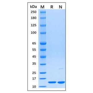aladdin 阿拉丁 rp169553 Recombinant Human β2-microglobulin Protein Carrier free, >95% SDS-PAGE, E.coli, N-His Tag, 21-119 aa