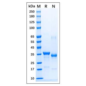 aladdin 阿拉丁 rp169651 Recombinant Human iNOS Protein Carrier Free, >90% (SDS-PAGE), E.coli, His Tag, 730-1058 aa
