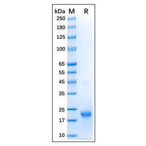 aladdin 阿拉丁 rp170121 Recombinant Human GTPase HRAS Protein Carrier Free, >95% (SDS-PAGE), E.coli, His tag, 2-186 aa