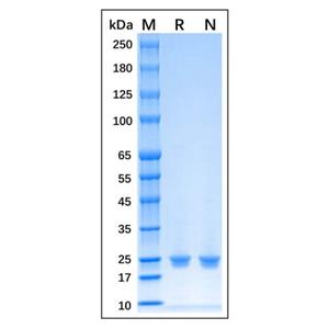 aladdin 阿拉丁 rp170396 Recombinant Human HRV 3C Protein Carrier free, >95% (SDS-PAGE), Active, E.coli, N-His tag, 1538-1719 aa