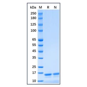 Recombinant Human UbcH5a/UBE2D1 Protein,Recombinant Human UbcH5a/UBE2D1 Protein
