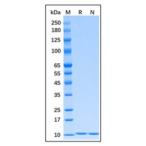 aladdin 阿拉丁 rp170435 Recombinant Human HA-Ubiquitin Protein Carrier Free, >98%(SDS-PAGE), E.coli, N-His-HA tag, 1-76 aa