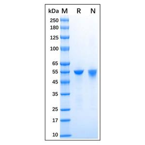 aladdin 阿拉丁 rp175922 Recombinant Human ALDH1A1 Protein Carrier Free, >95% (SDS-PAGE), E.coli, His tag, 2-501 aa