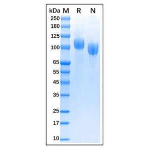 aladdin 阿拉丁 rp176265 Recombinant Bovine CD56 Protein Animal Free, >95% (SDS-PAGE), 293F cell, His tag, 20-719 aa