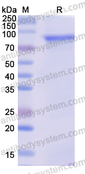 Recombinant Influenza A virus HA/Hemagglutinin Protein, N-His,Recombinant Influenza A virus HA/Hemagglutinin Protein, N-His