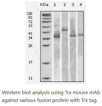 Thioredoxin (TRX),Thioredoxin