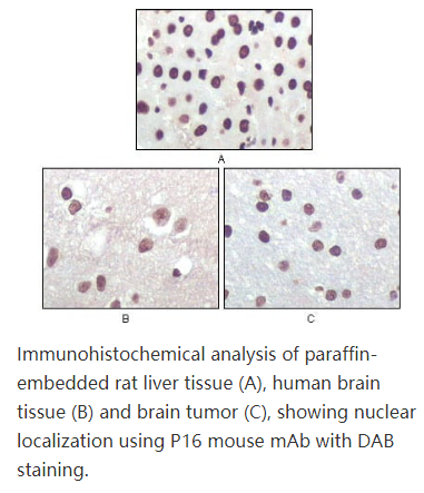 P16 (Mouse and Human),P16