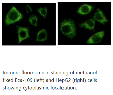 Cytokeratin (Pan),K5; DDD; EBS2; KRT5A; KRT5