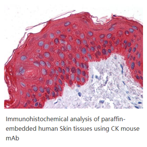 Cytokeratin (Pan),K5; DDD; EBS2; KRT5A; KRT5