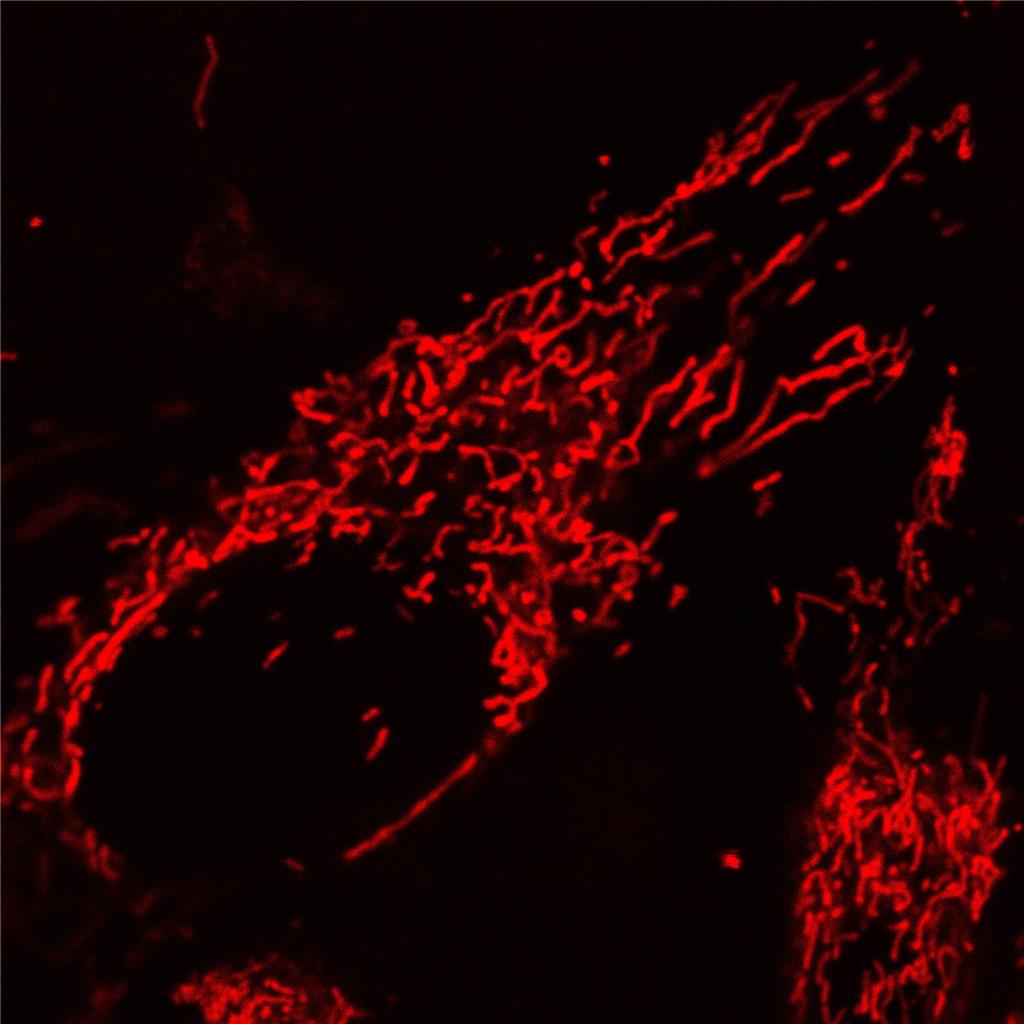 AIE线粒体红色探针,AIE Red Probe for Mitochondrion