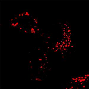 AIE溶酶体红色探针,AIE Red Probe for Lysosome